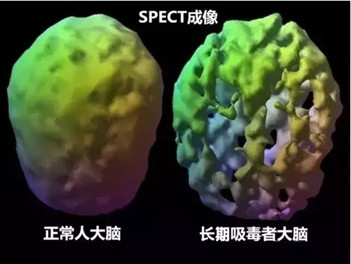 冰毒的危害比任何一種毒都可怕